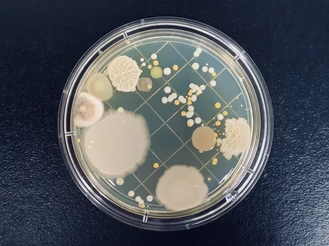 放線菌の培養写真